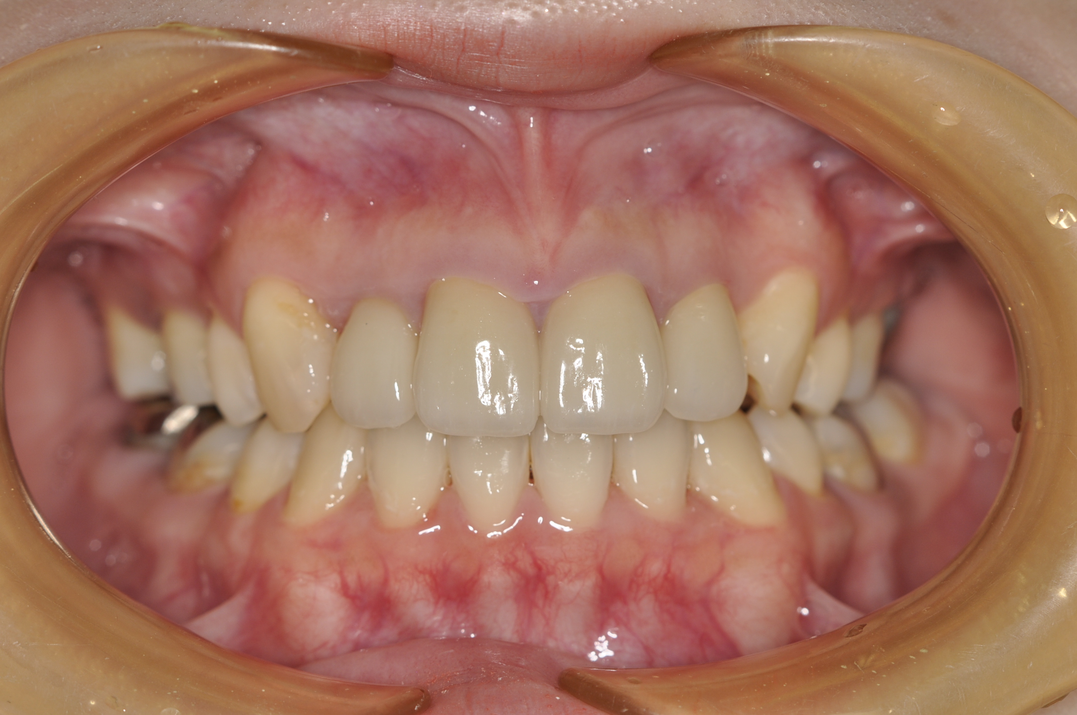 盛岡 歯科 矯正