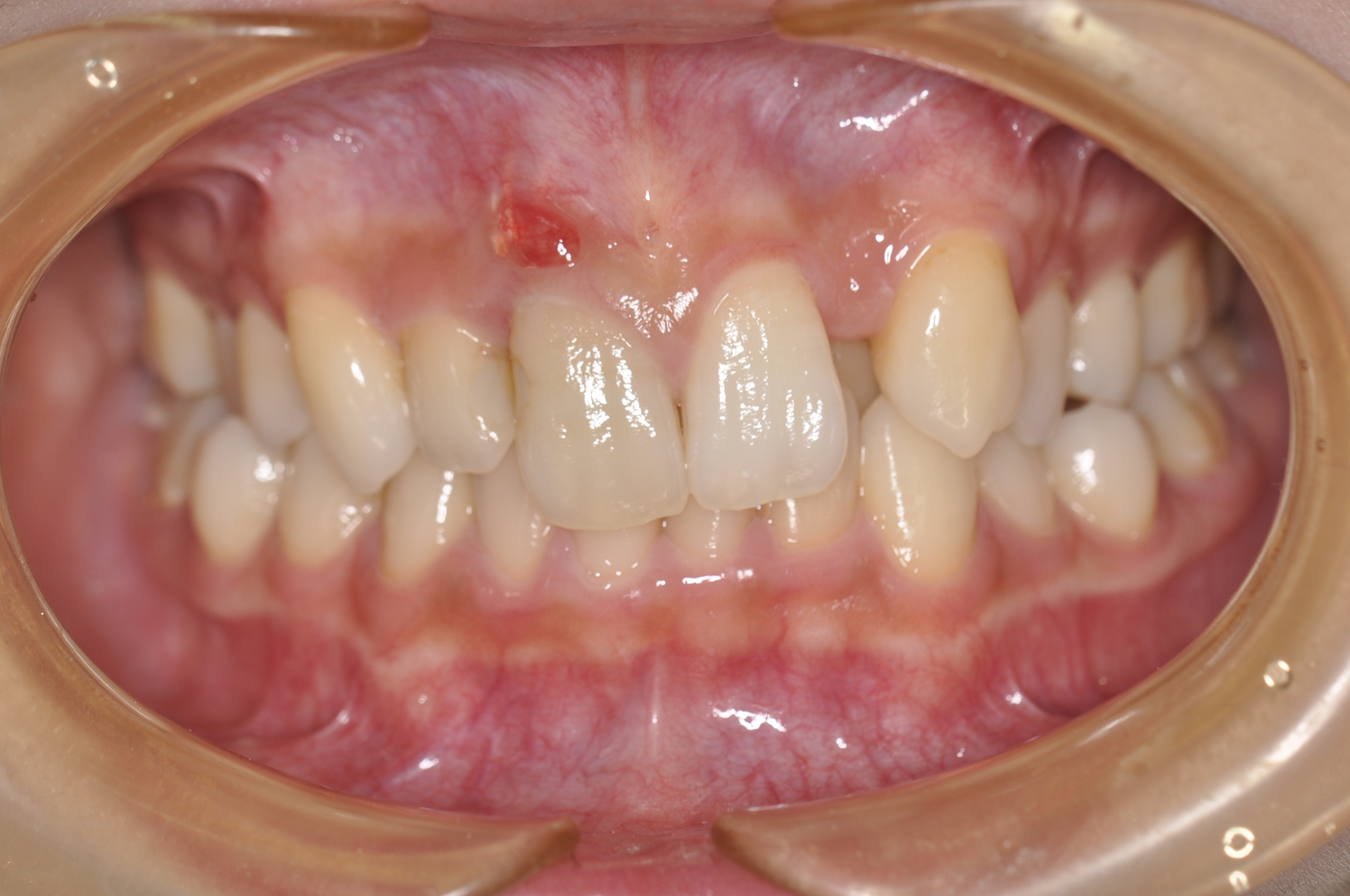 矯正 審美 盛岡