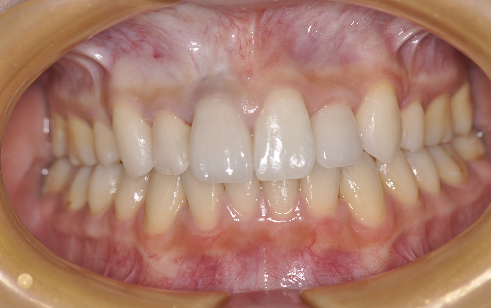 矯正 審美 盛岡