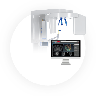 長持ちする治療